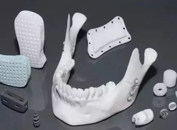 3D-Printed Bioceramics